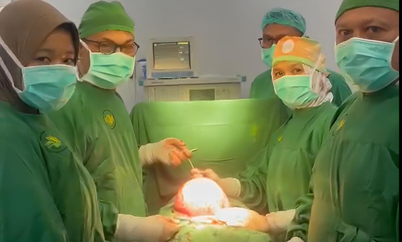 dr. Nova Roslita, Sp.OG dan Unit Bedah RSU Jeumpa Hospital Berhasil Mengangkat Tumor Berukuran 30 cm dengan Berat 2 Kg